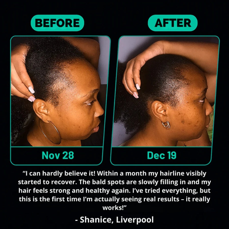 Batana Oil – Naturally Stronger, Shinier, Thicker Hair (Copy)