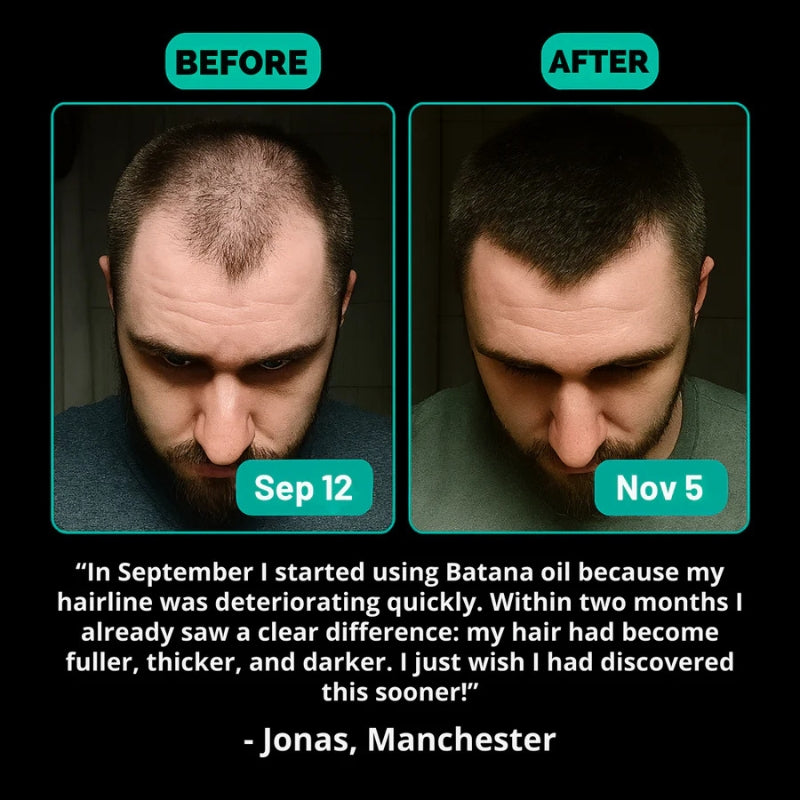 Batana Oil – Naturally Stronger, Shinier, Thicker Hair (Copy)